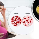 Main benefits of L-Methyl Folate in Depression