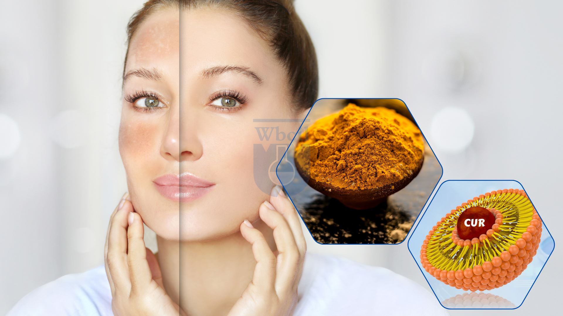 Liposomal Curcumin