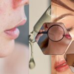Liposomal glycolic acid and salicylic acid serum