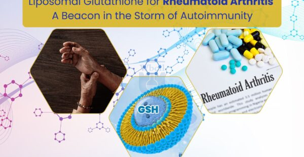 Liposomal Glutathione for Rheumatoid Arthritis