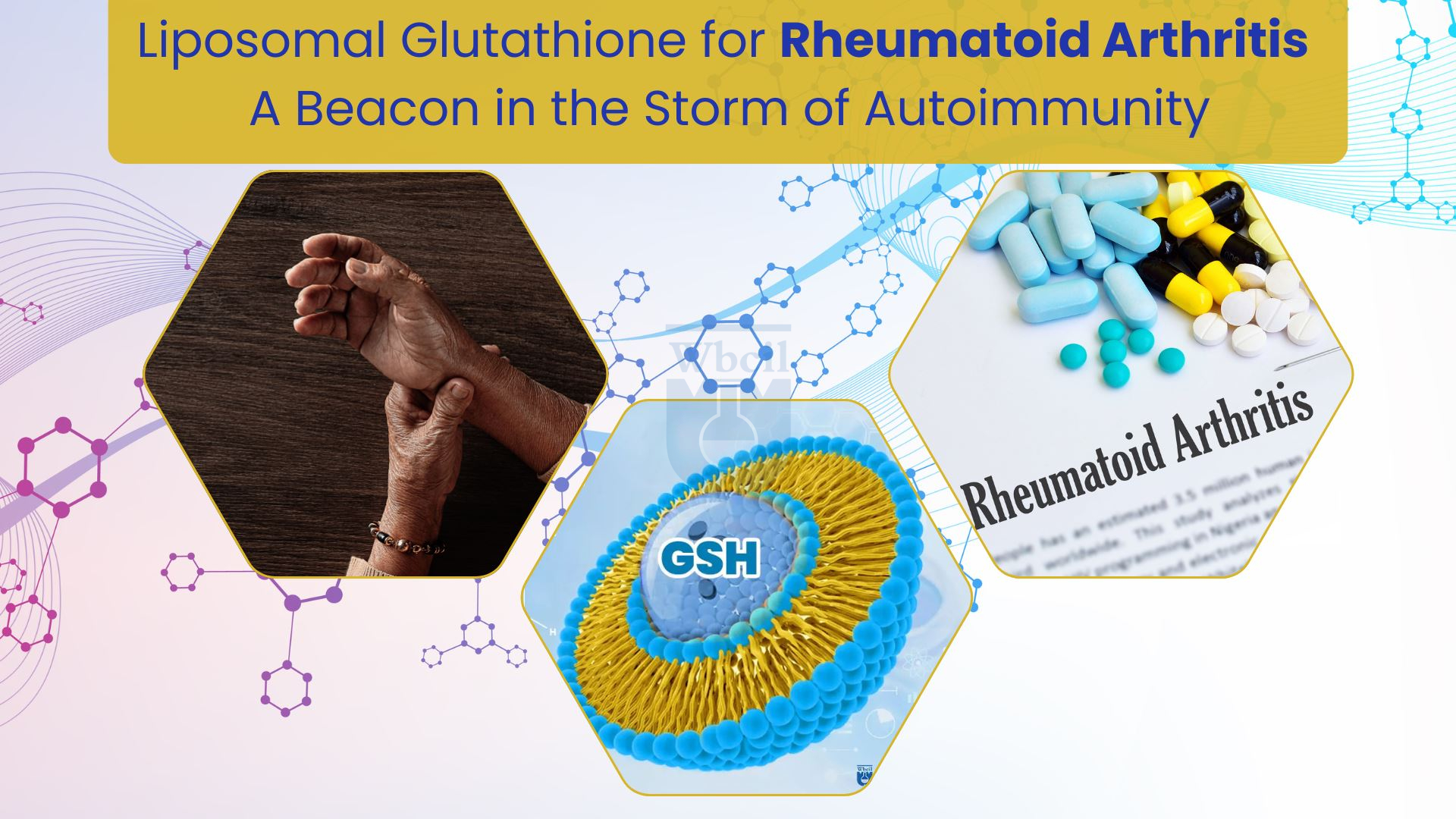 Liposomal Glutathione for Rheumatoid Arthritis