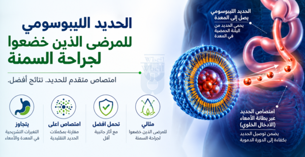 الحديد الليبوزومي لمرضى جراحة السمنة